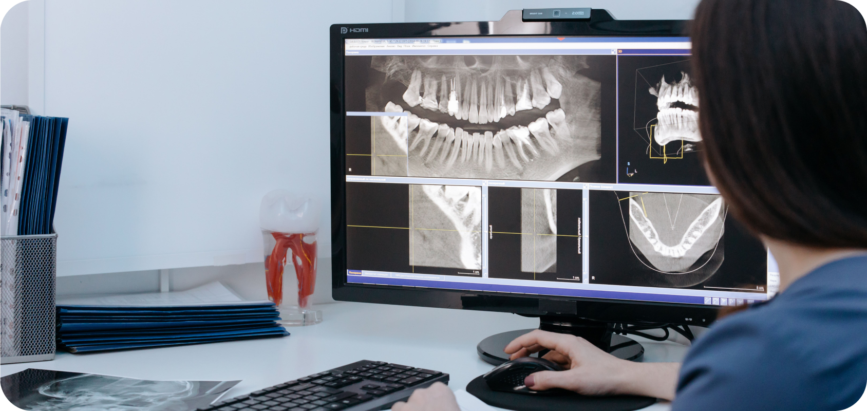 Feature adversarial training for semi-supervised medical image classification
